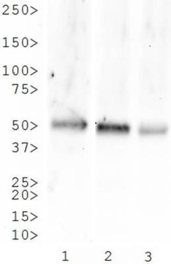 TACR1 Antibody in Western Blot (WB)