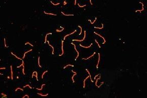 SCP3 Antibody in Immunocytochemistry (ICC/IF)