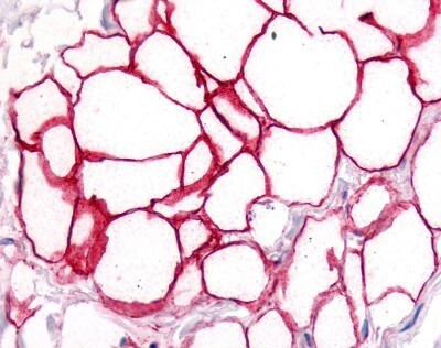 CD36 Antibody in Immunohistochemistry (Paraffin) (IHC (P))