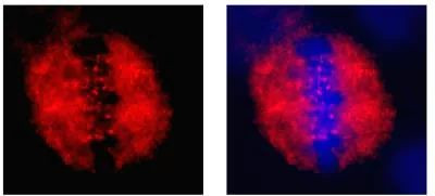 CENPF Antibody in Immunocytochemistry (ICC/IF)