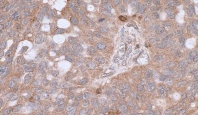 beta Actin Antibody in Immunohistochemistry (Paraffin) (IHC (P))