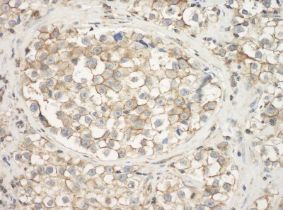 gamma Actin Antibody in Immunohistochemistry (Paraffin) (IHC (P))