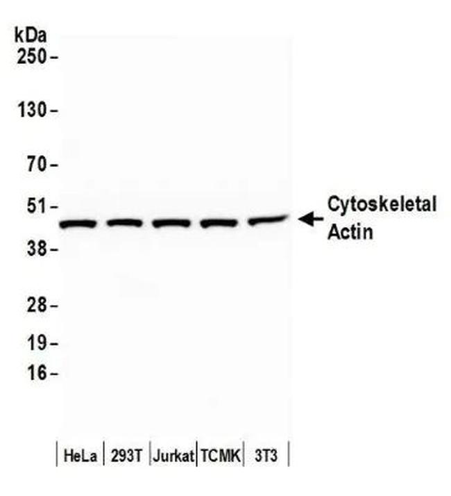 gamma Actin Antibody in Western Blot (WB)