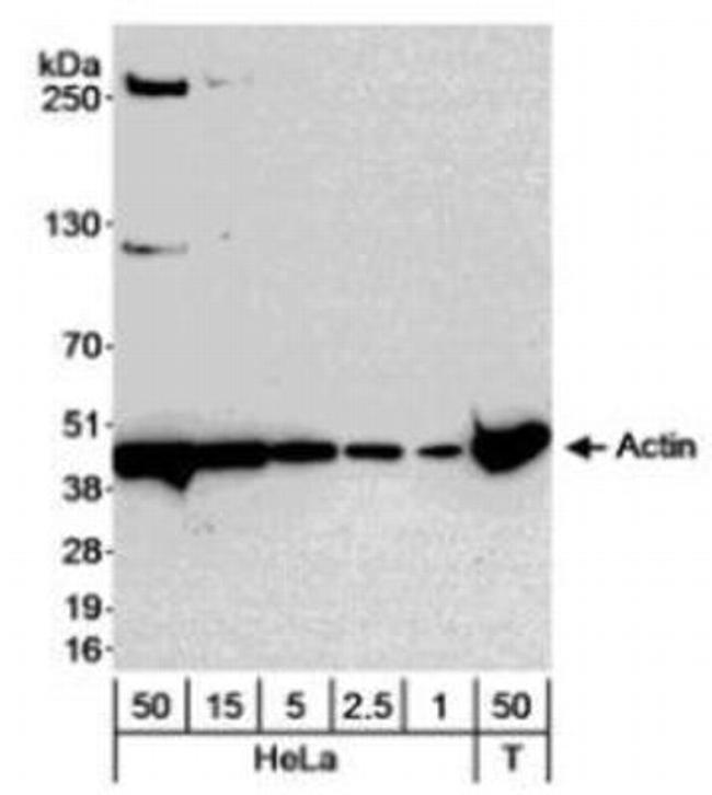 gamma Actin Antibody in Western Blot (WB)