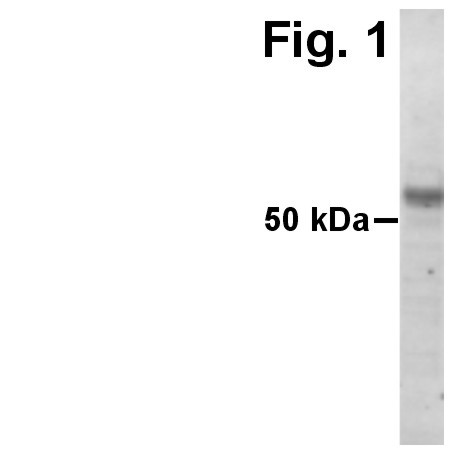 ADAMTS15 Antibody in Western Blot (WB)