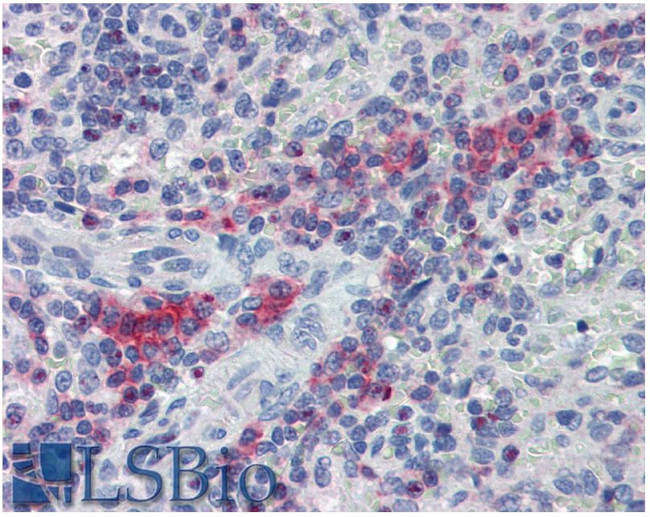 LIME Antibody in Immunohistochemistry (Paraffin) (IHC (P))