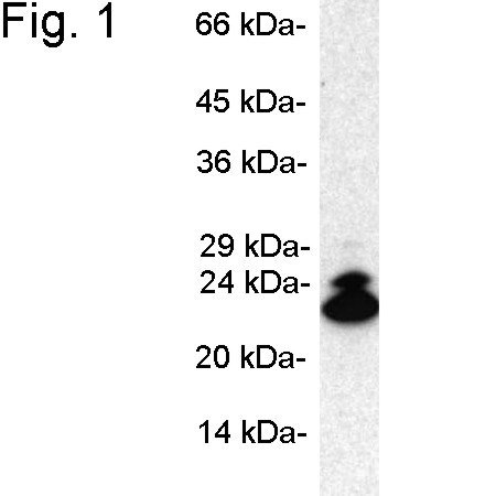 PSMB9 Antibody in Western Blot (WB)