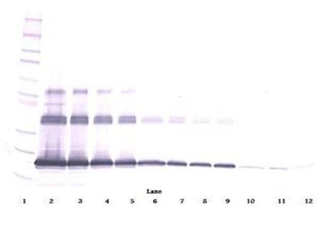 CD254 (RANK Ligand) Antibody in Western Blot (WB)