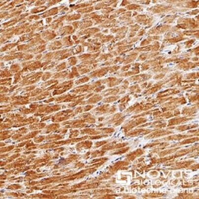 PHD3 Antibody in Immunohistochemistry (Paraffin) (IHC (P))