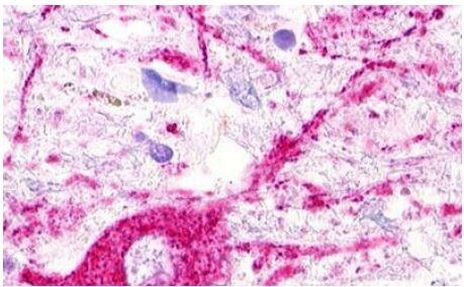 MAS1L Antibody in Immunohistochemistry (Paraffin) (IHC (P))