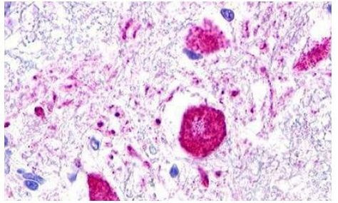 MAS1L Antibody in Immunohistochemistry (Paraffin) (IHC (P))