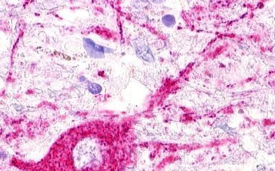 MAS1L Antibody in Immunohistochemistry (Paraffin) (IHC (P))