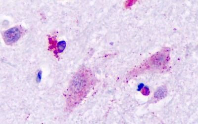 HRH3 Antibody in Immunohistochemistry (Paraffin) (IHC (P))