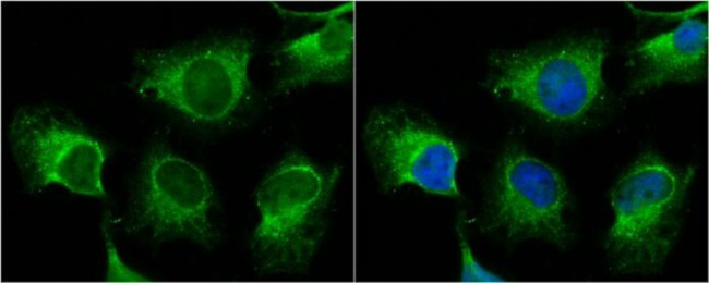 TNIK Antibody in Immunocytochemistry (ICC/IF)