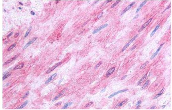 HTR1B Antibody in Immunohistochemistry (Paraffin) (IHC (P))