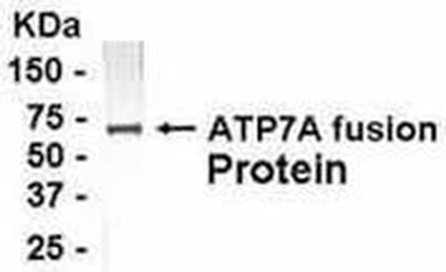 ATP7A Antibody in Western Blot (WB)