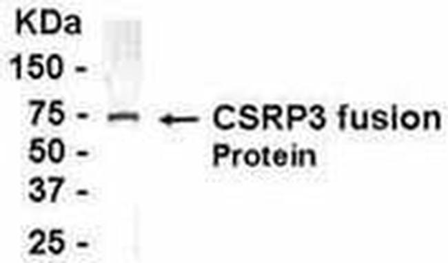 CSRP3 Antibody in Western Blot (WB)