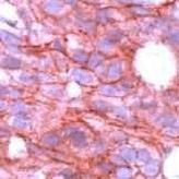 ErbB4 Antibody in Immunohistochemistry (Paraffin) (IHC (P))