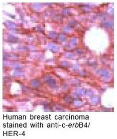 ErbB4 Antibody in Immunohistochemistry (IHC)