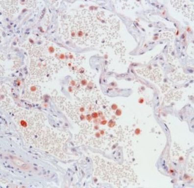 iNOS Antibody in Immunohistochemistry (IHC)