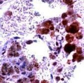 iNOS Antibody in Immunohistochemistry (IHC)