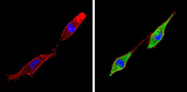 THRA Antibody in Immunocytochemistry (ICC/IF)