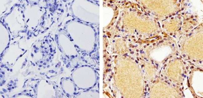 THRA Antibody in Immunohistochemistry (Paraffin) (IHC (P))