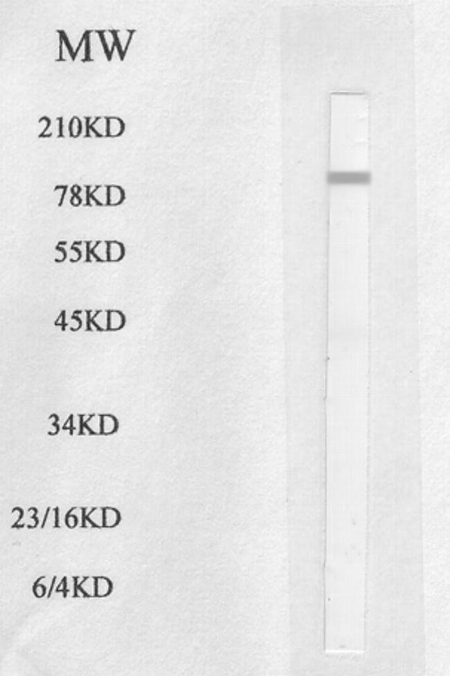 HSL Antibody in Western Blot (WB)