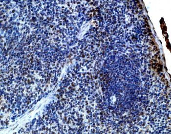 IL-21 Antibody in Immunohistochemistry (IHC)