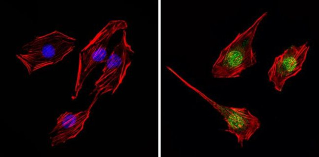 THRA Antibody in Immunocytochemistry (ICC/IF)