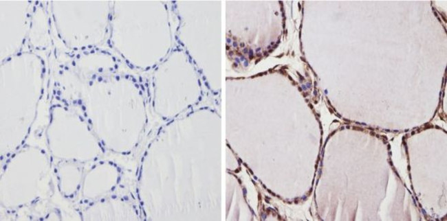 THRA Antibody in Immunohistochemistry (Paraffin) (IHC (P))