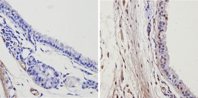 THRA Antibody in Immunohistochemistry (Paraffin) (IHC (P))