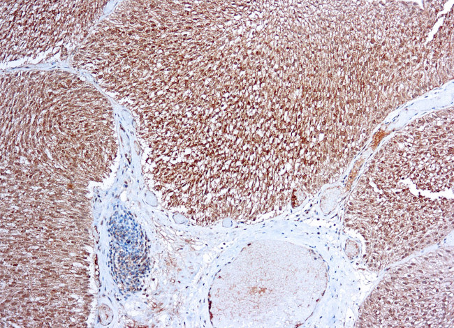 VEGF Receptor 1 Antibody in Immunohistochemistry (Paraffin) (IHC (P))