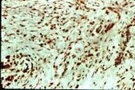 VEGF Receptor 1 Antibody in Immunohistochemistry (IHC)