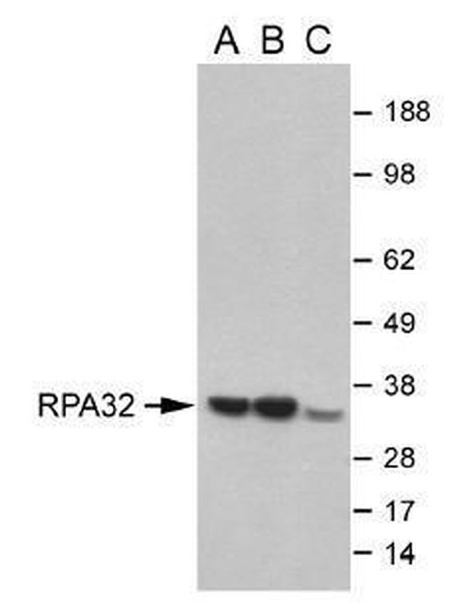 RPA2 Antibody in Western Blot (WB)