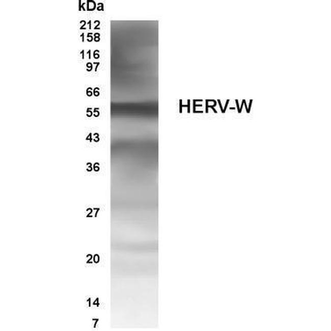 Human Endogenous Retrovirus Antibody in Western Blot (WB)