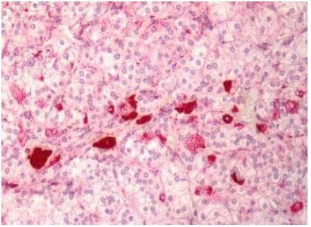 MC1R Antibody in Immunohistochemistry (Paraffin) (IHC (P))