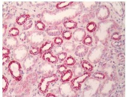 MC1R Antibody in Immunohistochemistry (Paraffin) (IHC (P))