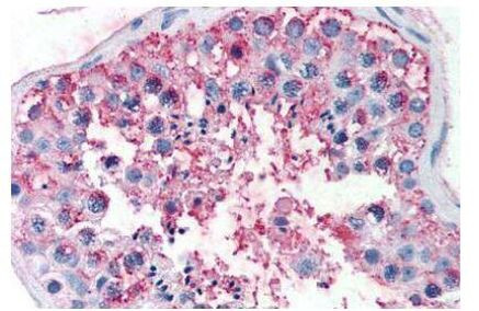 FSHR Antibody in Immunohistochemistry (Paraffin) (IHC (P))