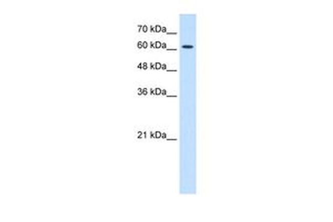 CHRNE Antibody in Western Blot (WB)