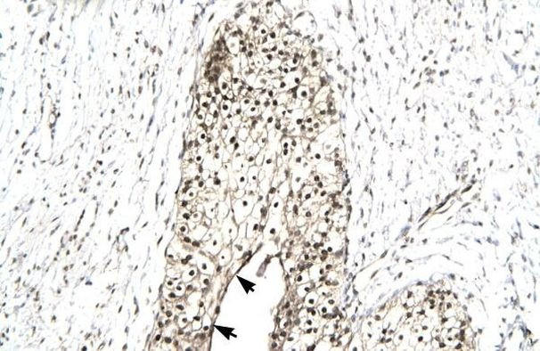 RUVBL2 Antibody in Immunohistochemistry (Paraffin) (IHC (P))