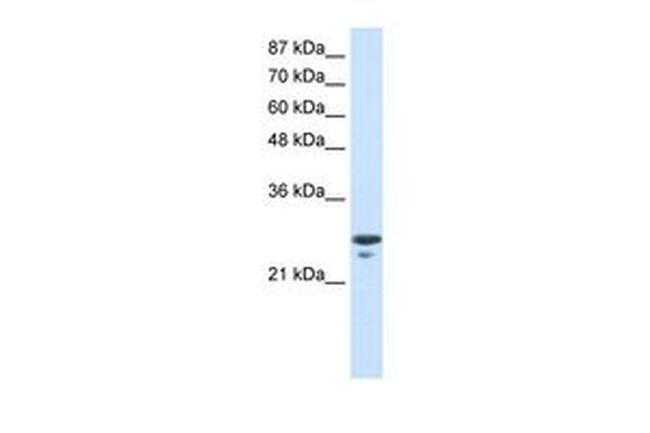 TFAM Antibody in Western Blot (WB)