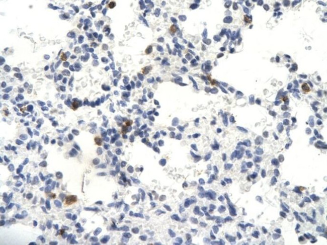 SNW1 Antibody in Immunohistochemistry (Paraffin) (IHC (P))