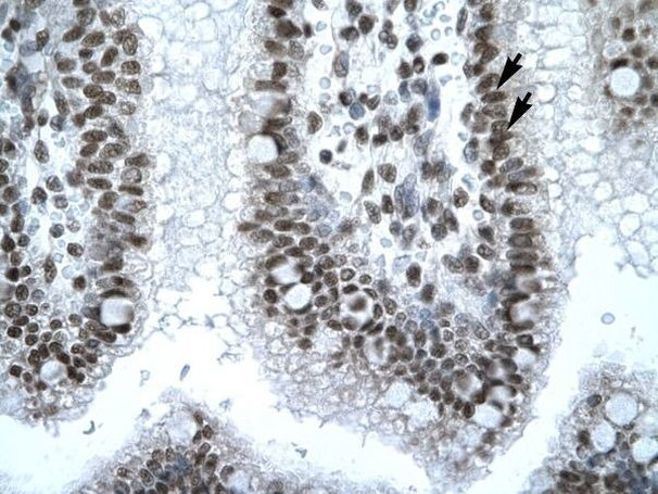 IRF8 Antibody in Immunohistochemistry (Paraffin) (IHC (P))