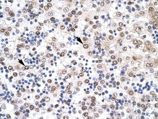 IRF8 Antibody in Immunohistochemistry (Paraffin) (IHC (P))