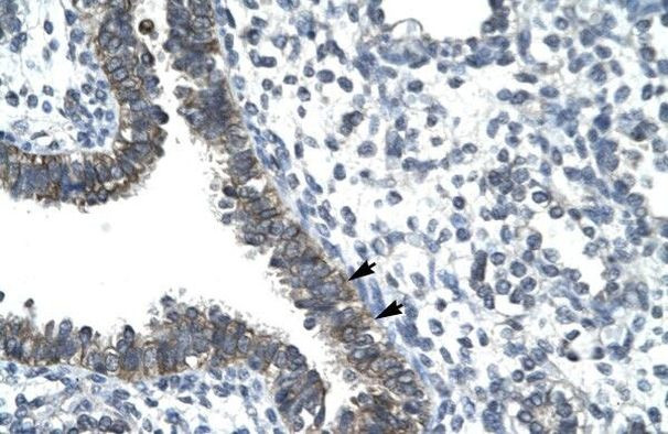 CCRN4L Antibody in Immunohistochemistry (Paraffin) (IHC (P))