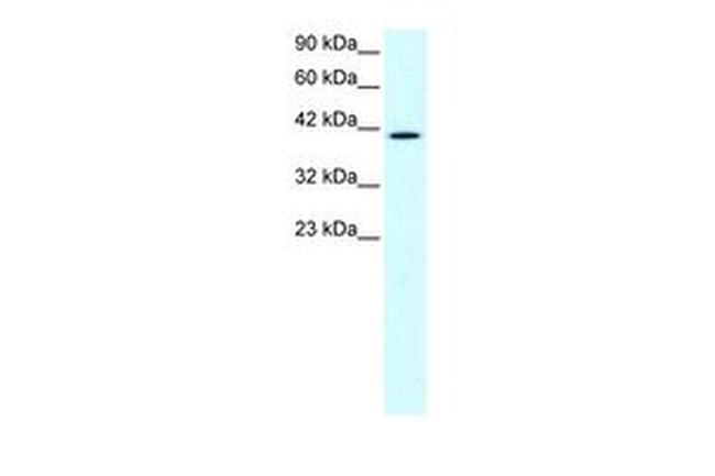 CCRN4L Antibody in Western Blot (WB)