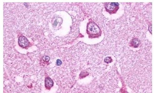 HTR5A Antibody in Immunohistochemistry (Paraffin) (IHC (P))