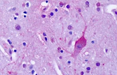 mGluR4 Antibody in Immunohistochemistry (Paraffin) (IHC (P))