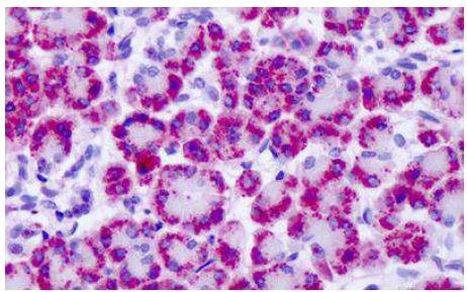 mGluR4 Antibody in Immunohistochemistry (Paraffin) (IHC (P))